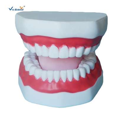 Plastic Dental Model of Tooth Anatomical Model with A 32 Tooth Dental Teaching Model