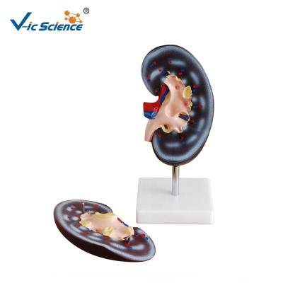 High Quality Medical Plastic Kidney Model (2 Parts) For Teaching