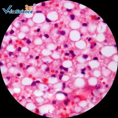 100Pcs Microscope Human Pathology Prepared Slides Set