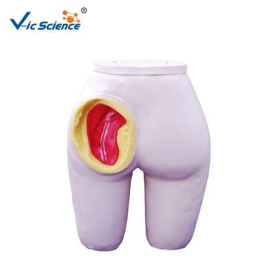 Hot Sale Advanced Intramuscular Injection Training Artificial Buttocks Model